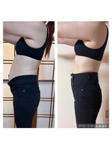 ヨサパークカーラ 宮崎駅(YOSA PARK CARA)/痩身ビフォーアフター