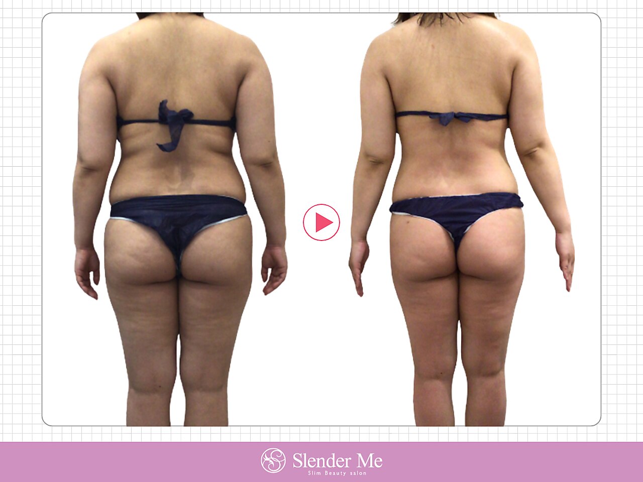 スレンダーミー 甲府本店(Slender Me)｜ホットペッパービューティー