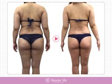 スレンダーミー 甲府本店(Slender Me)