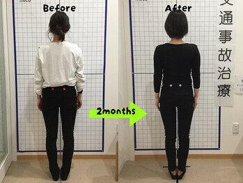 ニコ(nico)/施術と筋力トレーニングで変化！