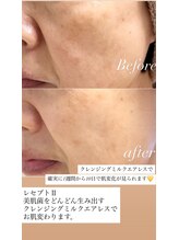 エステドブルー(Este de Bleu)/ビフォーアフター