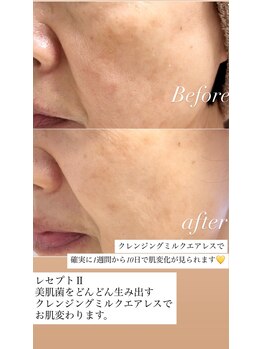 エステドブルー(Este de Bleu)/ビフォーアフター