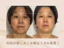 美カナエル(美kanaeru)/顔周りのケアで小顔に整える