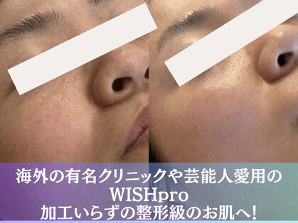 ブルーム(BLOOM)の写真