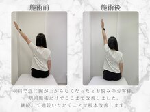 整体リライン 生駒院(整体Re:Line)/改善チェック
