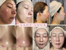 レディラック 大阪梅田本店(Lady Luck)の雰囲気(肌質やお悩みに合わせたオーダーメイドフェイシャルコース充実!)