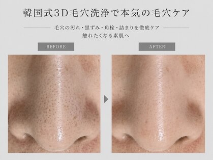 ヴィヴィッド(vivid)の写真