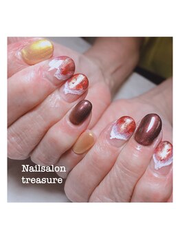 トレジャー(treasure)/