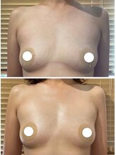 ルナグランデ(Luna grande.)/全体的にボリュームアップ♪