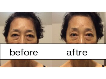 ウェルビープラーカ(Well-beプラーカ)/目元パッチリ、明るくなります。