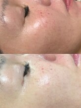 クラウドナイン(CLOUD9)/VOSサロンケア