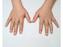 スノー(SNOW)/キッズハンドネイルケア