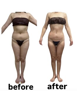 ウィズルーチェ 神栖店(with luce)/50代〇〇さんの変化　痩ボディへ