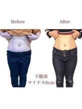 整体院トトノエル 西川原院/Before→After 