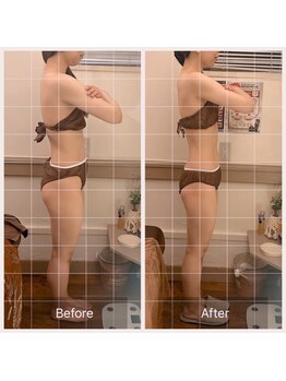 カルナ(carna)/《3か月計6回》2週間に1回