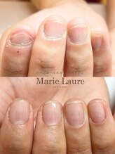 マリーロール 淀屋橋本店(Marie Laure)/自爪育成/深爪矯正/ネイルケア