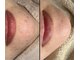 エリュクス(et Luxe)の写真