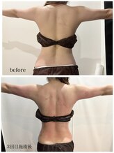 テンディ(TenD.)/サイズダウン