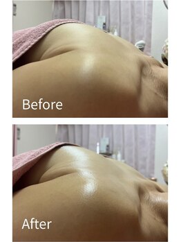 チュラ 大宮店(Chura)/【50代】初回バストケア(2/2)