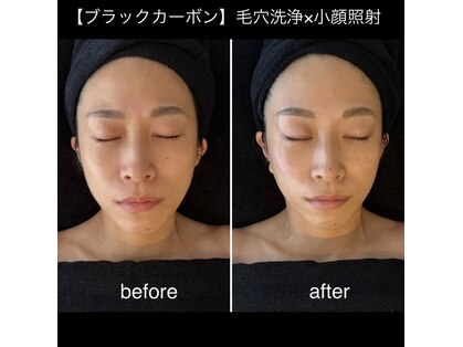 シスリー(CICELY)の写真