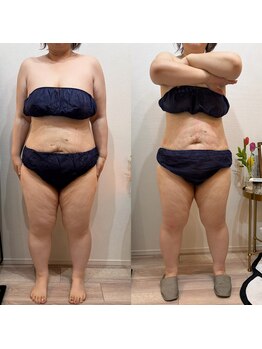 ヒメ ビューティー(Hime beauty)/2回