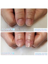 ちひろのへや/スペシャルハンドケア