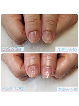 スペシャルハンドケア