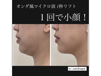 リアン 南熊本店(Lien)の写真