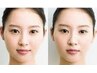 【女性】　姿勢矯正+小顔矯正　80分→3000円