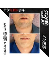 リノミラ(LINOMIRA)/効果に満足いただけてます☆