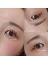 ルーフアイ(ROOF EYE)/ROOF EYE(ルーフ アイ)