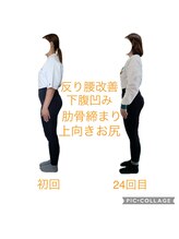 フォーシー(4C)/Before/After