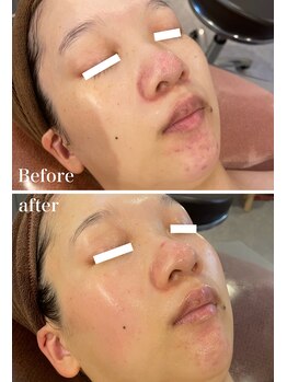 オレアグリーン 岡崎(OLEA green)/