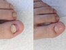 【フットケア】１本から対応/ケア後カラーネイル対応メニューから選択◎