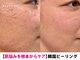 ベリンダ(BELINDA)の写真