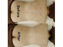 メグリ(Megurii)の雰囲気（目の疲れ、頭痛、疲労回復、小顔すべて即効性に自信あり◎）