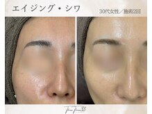 スリースリー(THREE THREE)/エイジング・しわケア