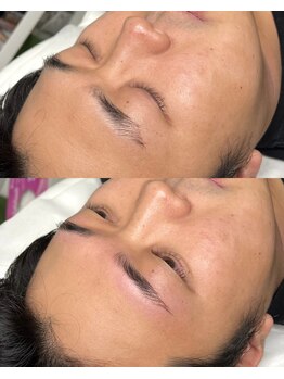 アマールシ 円山店(Amarsi)/眉癖改善【間引き・メンズ眉】