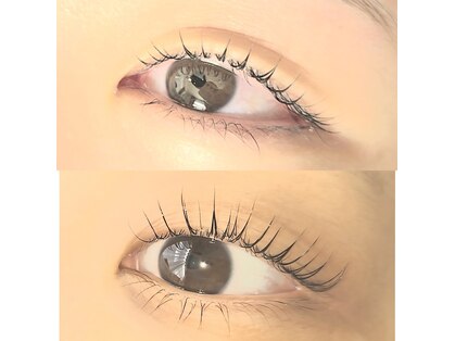 ラキ(LAKI)の写真