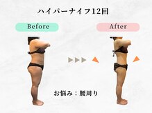 美容整体ウェリナ 中川八田院/小顔矯正/骨盤矯正/痩身整体