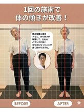 のなか整体院/整体 Before→After