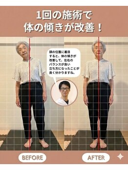 のなか整体院/整体 Before→After