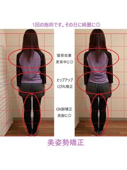 ツリーバランス(Tree Balance)/姿勢美人に◎