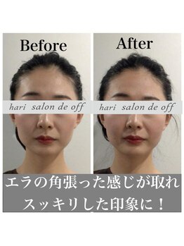 ハリサロンドオフ 心斎橋店(hari salon de off)/エラ張りはすぐに対処！
