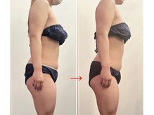 サロン ド ベル(salon.de.Belle)/インドマッサージbefore→after