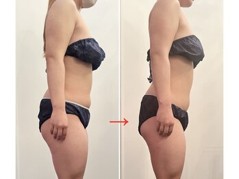 サロン ド ベル(salon.de.Belle)/インドマッサージbefore→after