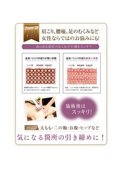 アリビオ(Alivio)/気になるパーツにアタック!