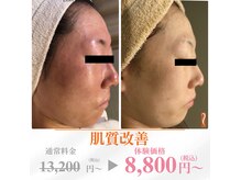 アンジェラックス 松本南店