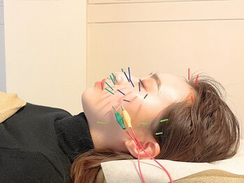 アム(aM)/清潔感ある空間で美容鍼