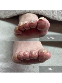 アイル(isle)/【爪が切れない】お客様のお悩み